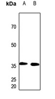 Anti-PEX7 Antibody