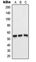 Anti-PFKFB1/4 Antibody