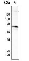 Anti-PFKFB2 (Phospho-S483) Antibody