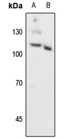 PGR (phospho-S294) antibody