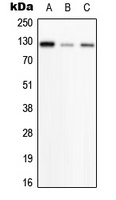 Anti-PHKB Antibody