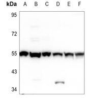 PHKG1 antibody