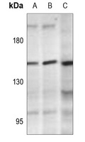 Anti-PLC gamma 2 (Phospho-Y1217) Antibody