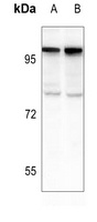 PML antibody