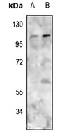 PMS1 antibody