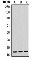 Anti-POLR2H Antibody