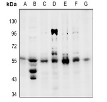 PPARG (phospho-S112) antibody