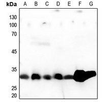 Anti-Cathepsin A 32k Antibody