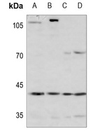 Anti-ARD1 Antibody