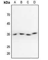 Anti-PPP2CA (Phospho-Y307) Antibody