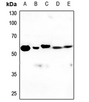 Anti-PPP2R5A Antibody