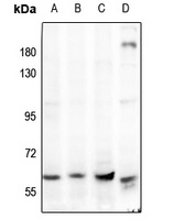 Anti-AMPK alpha 1/2 Antibody