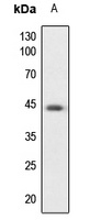 Anti-PKA C alpha/beta/gamma Antibody