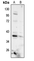 AMPK gamma 1 Rabbit Polyclonal Antibody