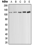 PRKD1 (phospho-S910) antibody