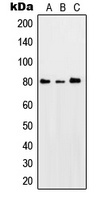 Anti-PKC theta (Phospho-S676) Antibody