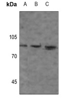 Anti-Beta-glucosidase 2 Antibody