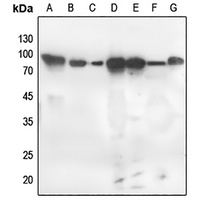 PKC zeta (phospho-T560) antibody