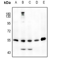 Anti-JNK1/2/3 (Phospho-T183) Antibody