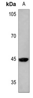 Anti-MKK1 (Phospho-T292) Antibody
