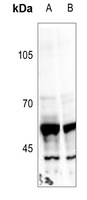 PRPH antibody