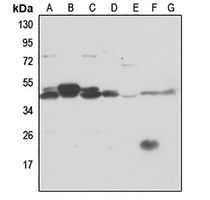 Anti-PSMC6 Antibody