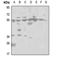 PSMD12 antibody