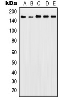 Anti-Patched Antibody