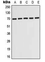 Anti-ABCD3 Antibody