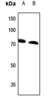 Anti-ABCD4 Antibody