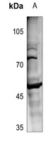 MOK antibody