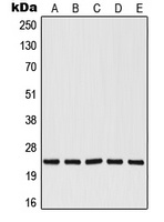 Anti-RALB Antibody