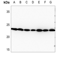 RAN antibody