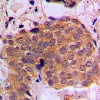 RAN Rabbit Polyclonal Antibody