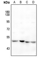 Anti-RAR beta Antibody