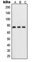 Anti-NF-kappaB p65 (Phospho-S311) Antibody