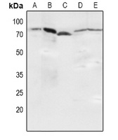 Anti-NF-kappaB p65 (Phospho-S536) Antibody
