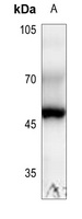 Anti-RPL3 Antibody