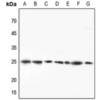 Anti-RPL10 Antibody