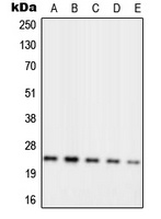 Anti-RPL10 Antibody