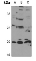 Anti-RPL11 Antibody