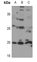 RPL11 antibody