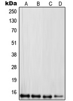 Anti-RPL30 Antibody