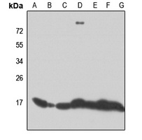 Anti-RPL28 Antibody