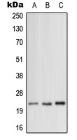 Anti-MRPL12 Antibody
