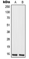 Anti-MRPS12 Antibody