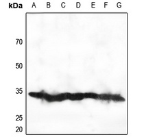 Anti-RPS2 Antibody