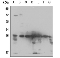Anti-RPS3 Antibody