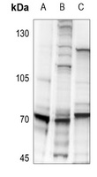 RPS6KB1 (phospho-S418) antibody