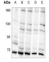 S6K1 (phospho-T421) antibody
